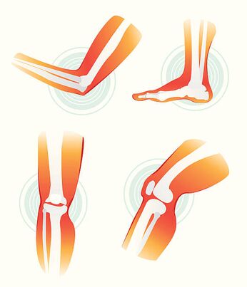 Causes of joint pain