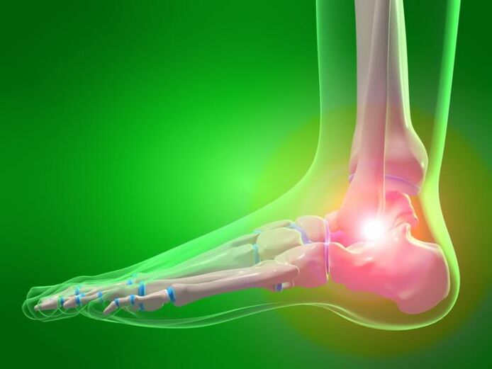 inflammation of the ankle joint with arthropathy