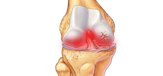 what does the knee joint look like