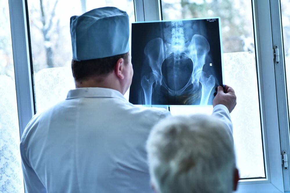 The doctor examines an image of a hip joint with arthrosis